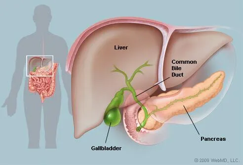Can Gallbladder Stones Be Removed Naturally?