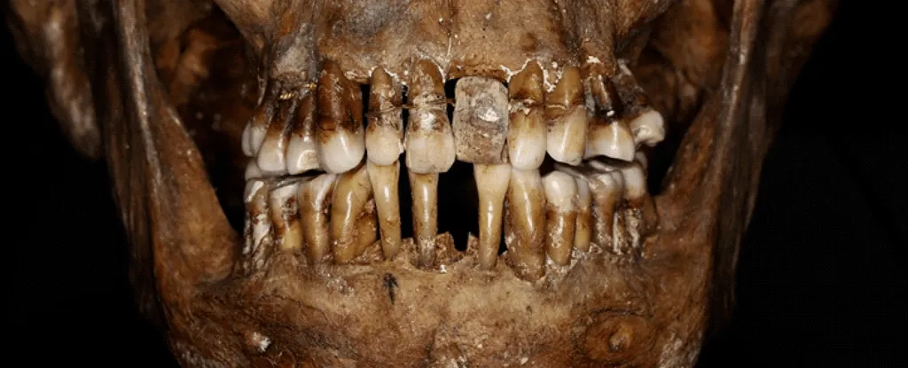 dental prosthetic