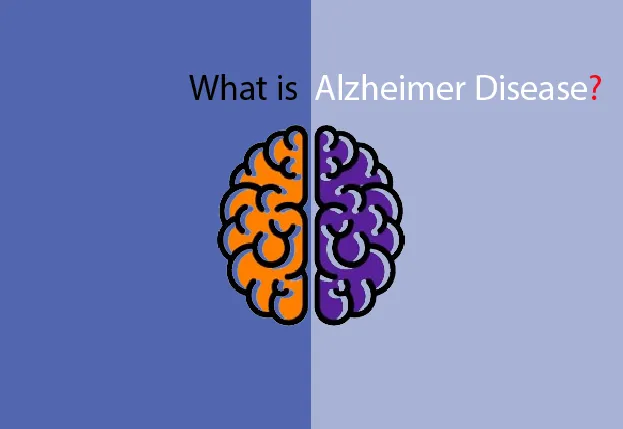 What is Alzheimer’s disease