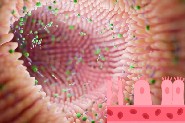 Leaky Gut Graphic