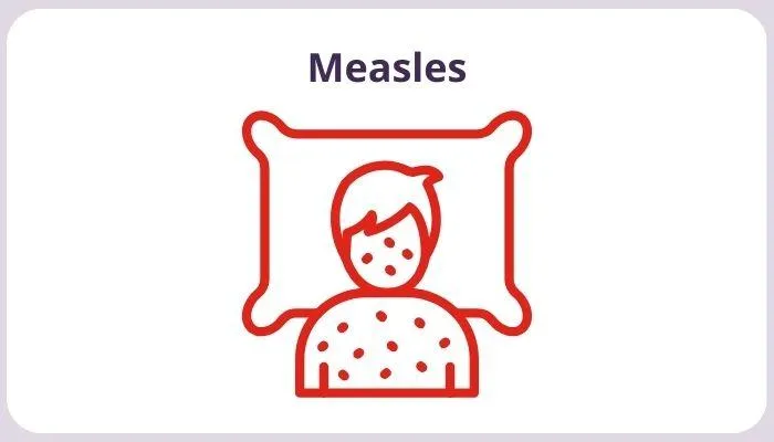 Measles in Early Childhood: Causes, Impacts, and Prevention