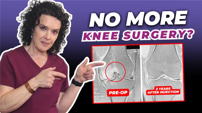 Knee Replacement vs. Stem Cells: Real Results