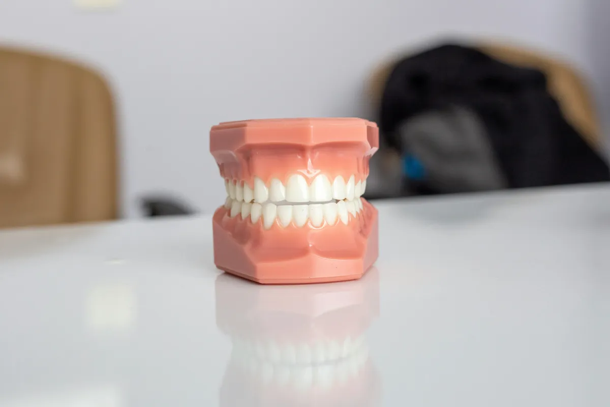 dental model on counter, wisdom teeth removal