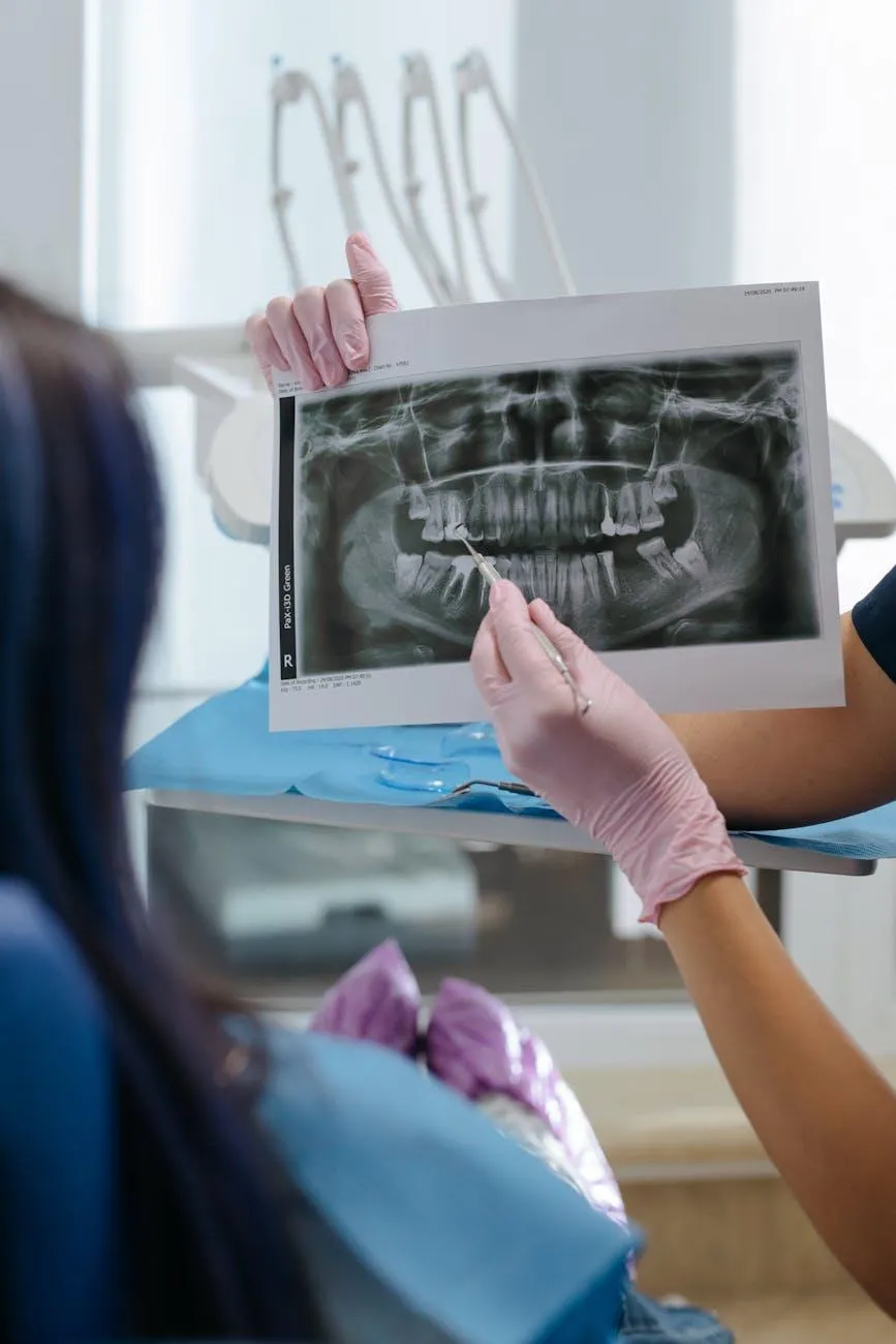 dental x-ray