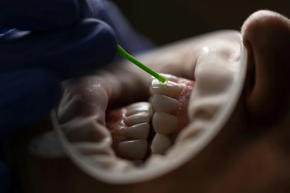 Critical Indicators You Should Extract Wisdom Teeth