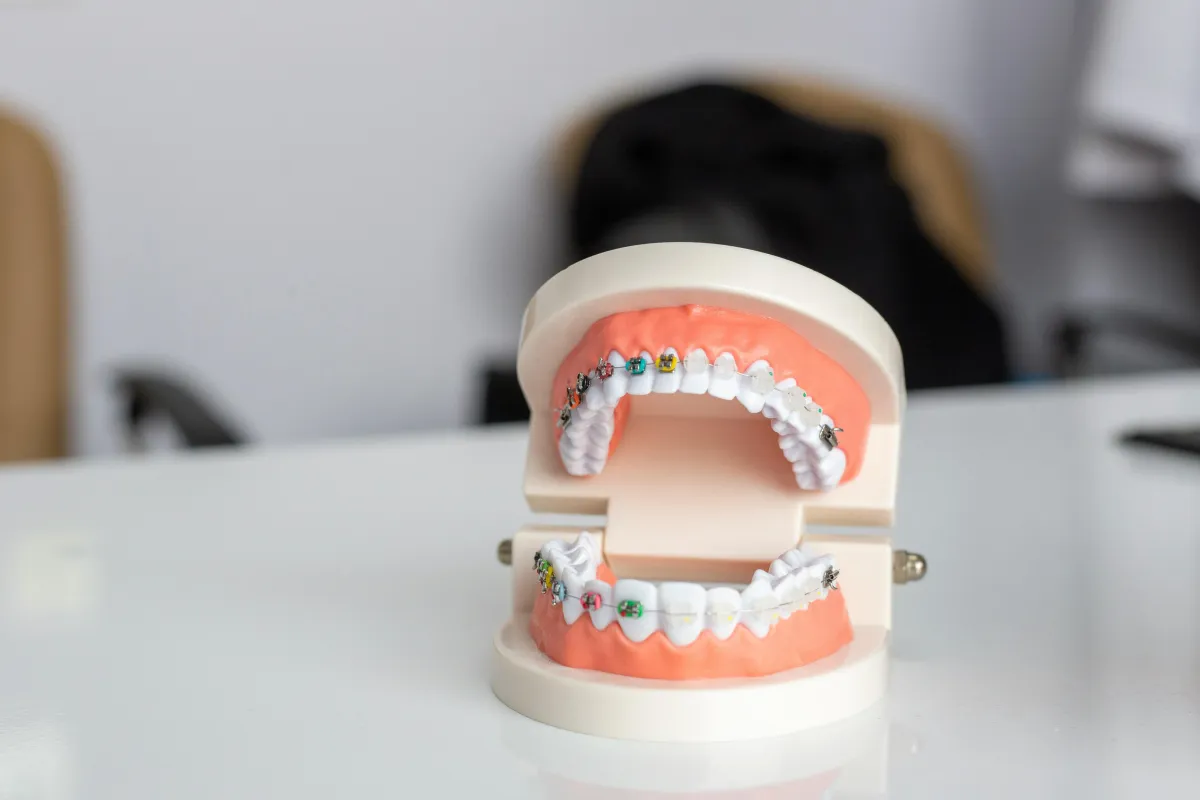 dental mold