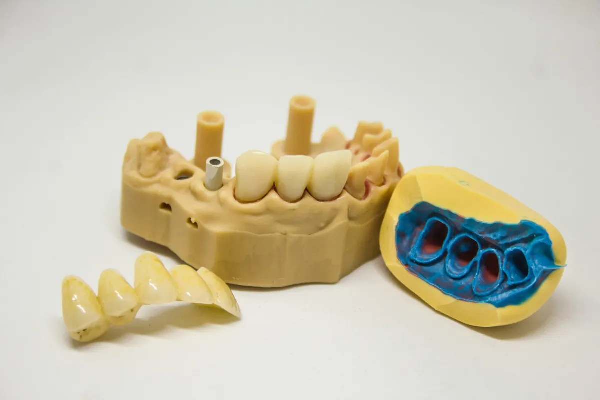 dental model missing teeth