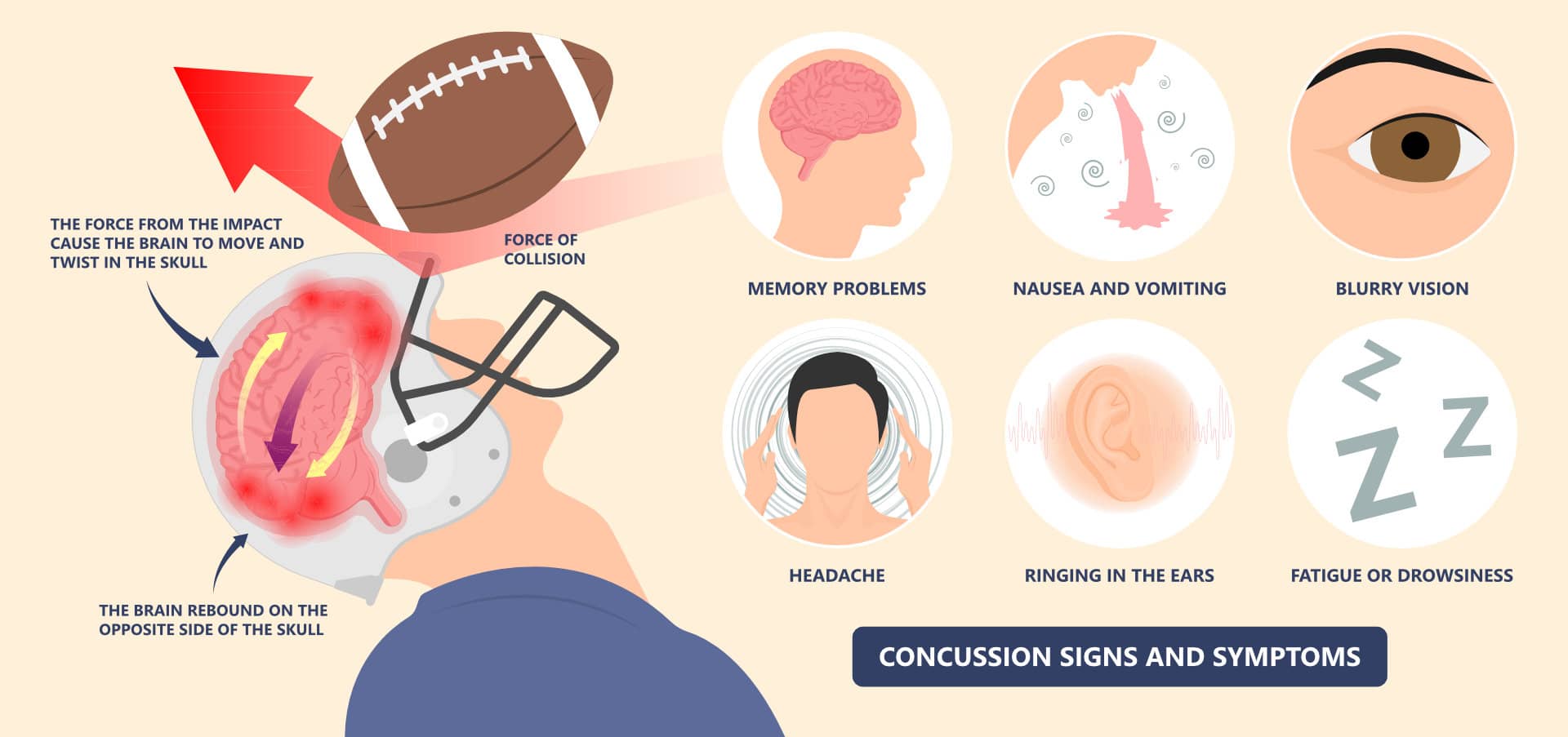The preventative effects of Environmental Enrichment for Traumatic Brain Injury in question