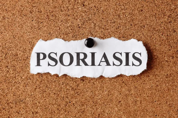 Psoriasis and Joint Pain