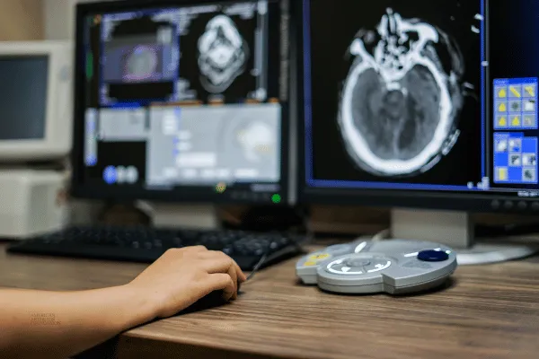 How New Imaging Technology is Changing Arthritis Diagnosis and Treatment