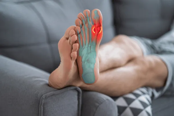 Millions of Americans Struggle with Gout: The Ongoing Challenge of Treatment Adherence