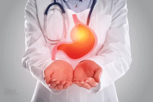 The Link Between Acid Reflux and Rheumatoid Arthritis Treatment