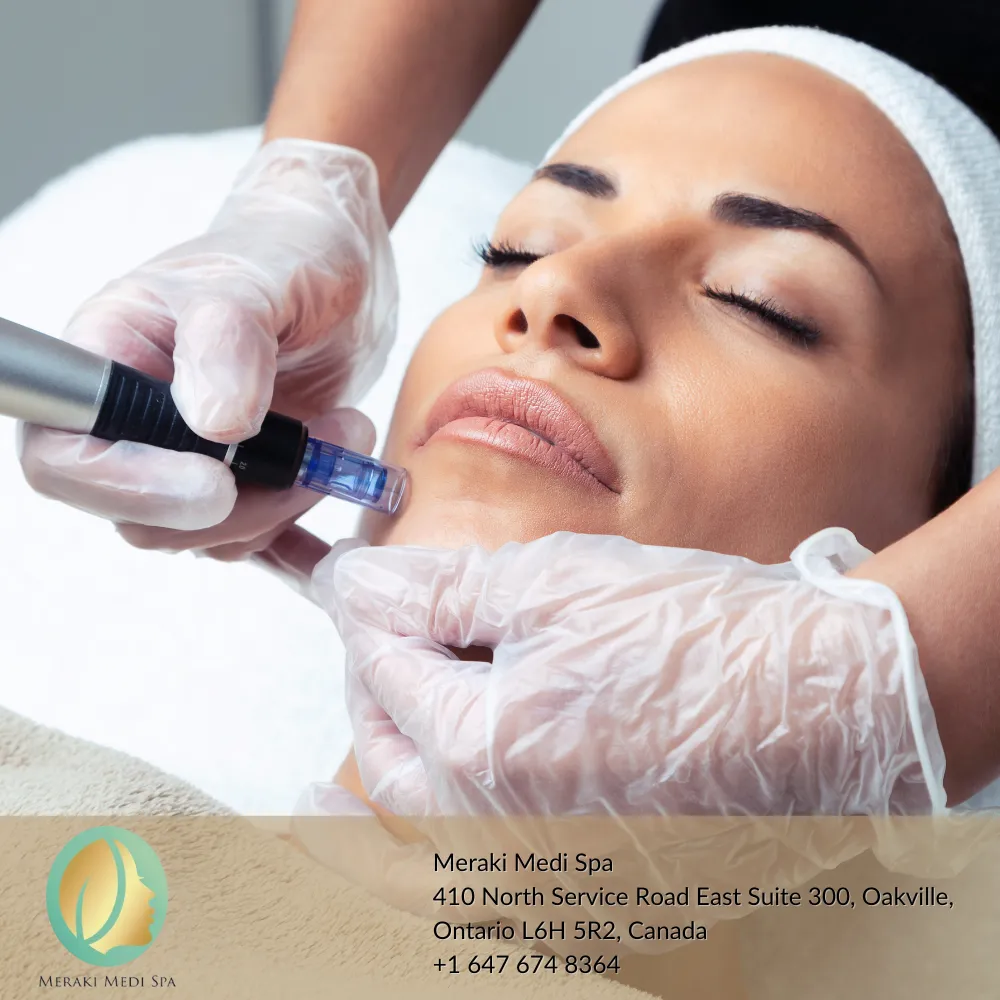 How to Choose the Right Medical Spa in Oakville for Your Skincare Needs | Meraki Medi Spa Oakville