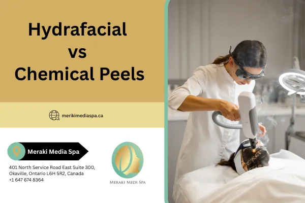 Hydrafacial vs Chemical Peels