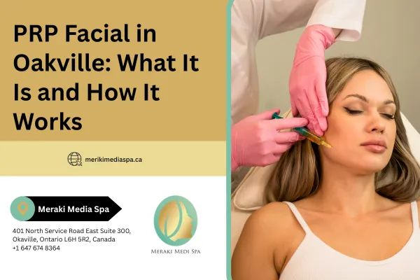 PRP Facial in Oakville