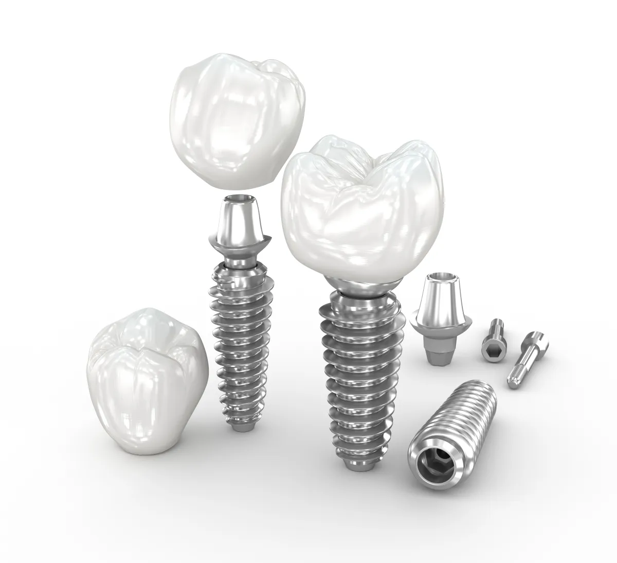Dental Implant diagram on a transparent background