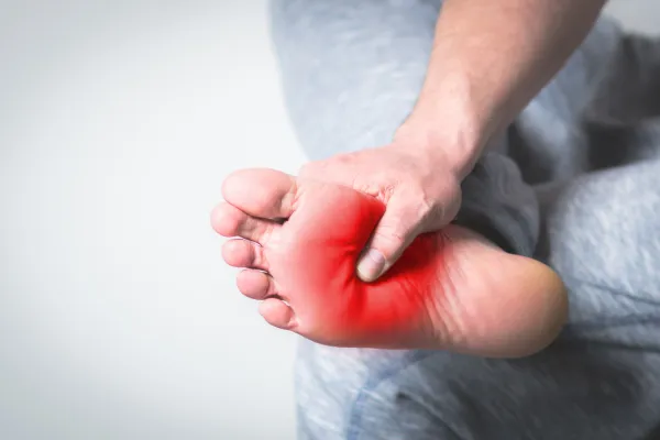 Why Your Arches Collapse (and How to Support Them)