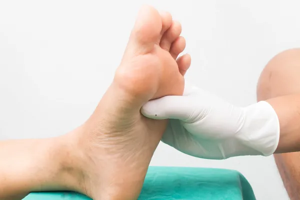 Why That Lumpy Spot on Your Foot Might Be a Ganglion Cyst