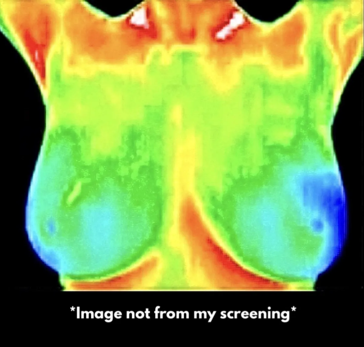 Screening