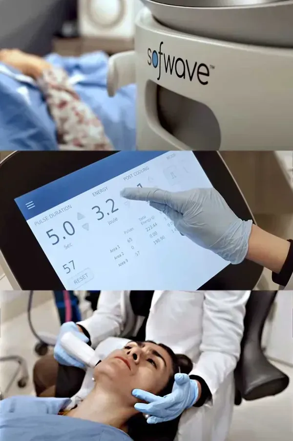 Sofwave at Jacksonville IL Medspa Clould Nine Aesthetics