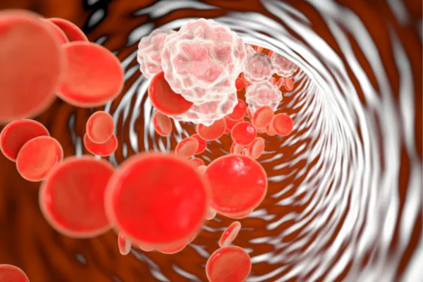inflammation