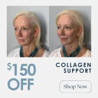 Under-Eye or Lip Threads | $150 OFF – Image 1