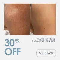IPL | 30% OFF – Image 1