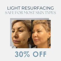 CoolPeel® or Pixel | 30% OFF – Image 1