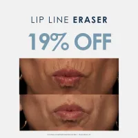 Lip Line Eraser | "Smokers Lines" – Image 1