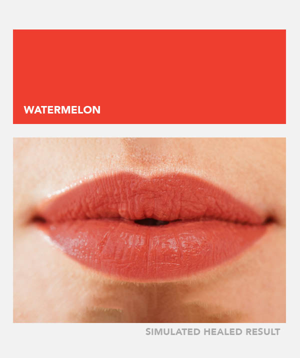 Watermelon – Image 4