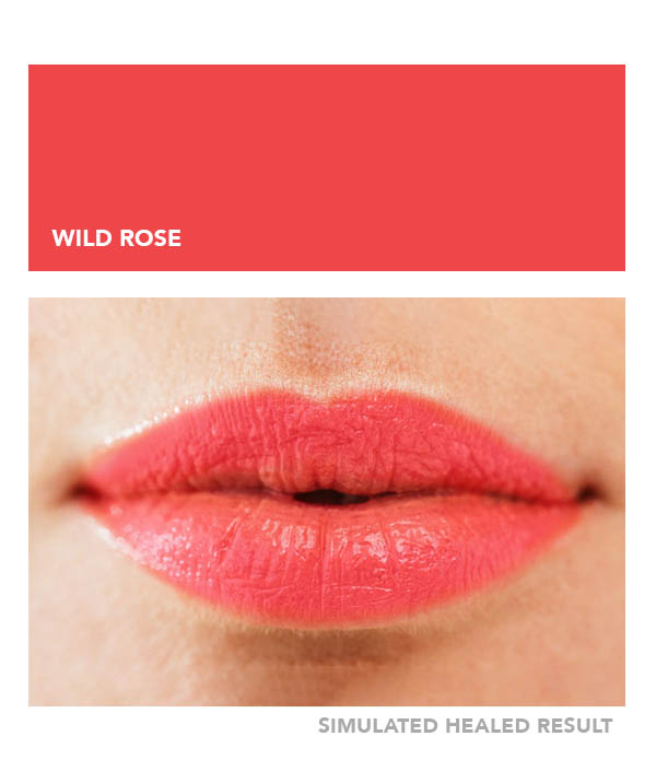 Wild Rose – Image 4