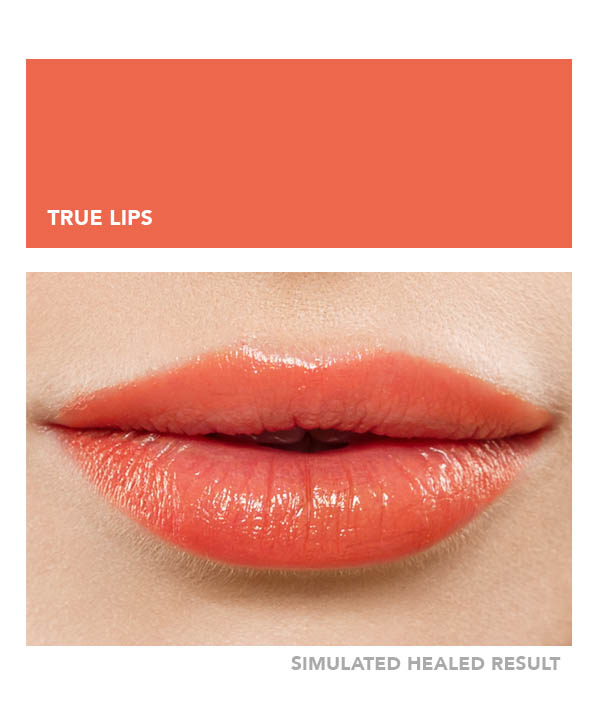 True Lips – Image 8