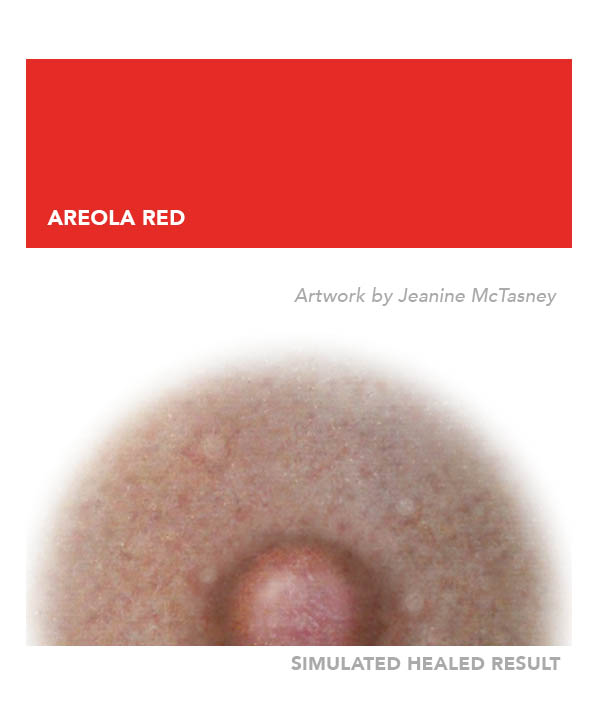 Areola Red – Image 8