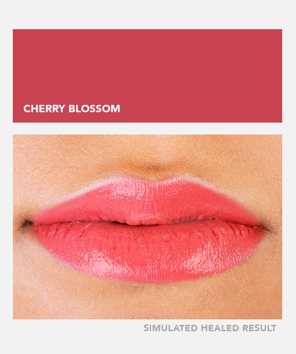 Cherry Blossom – Image 4