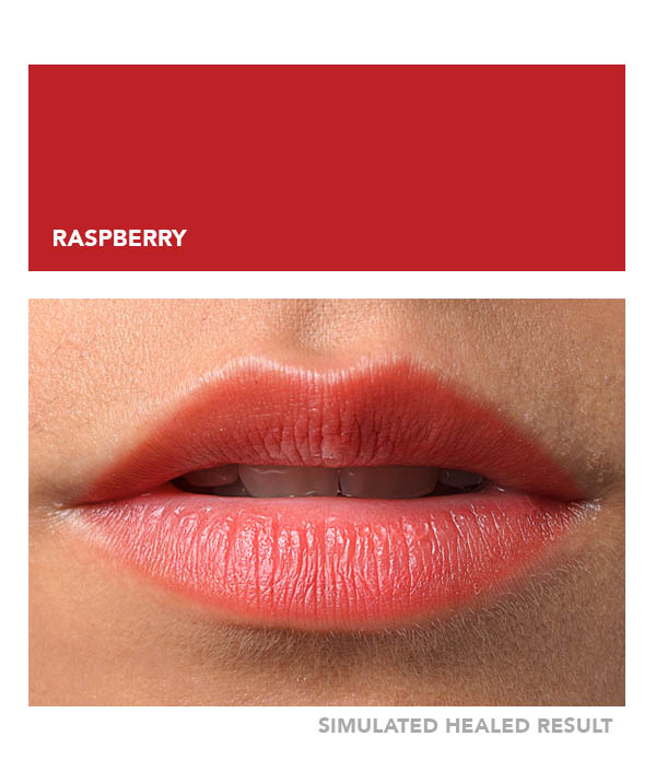 Raspberry – Image 4