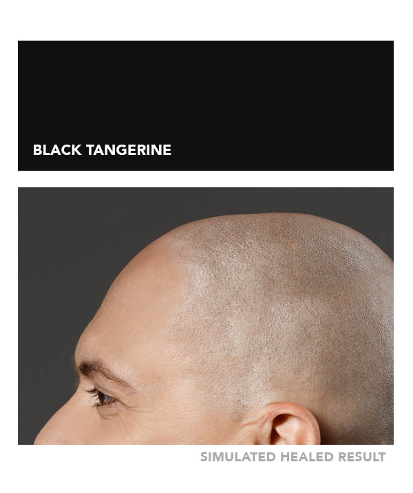 Black Tangerine – Image 4