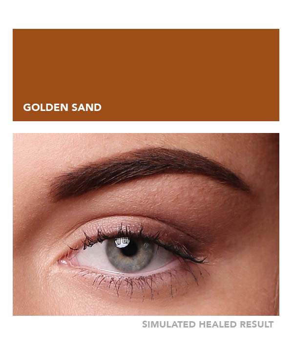 Golden Sand – Image 4