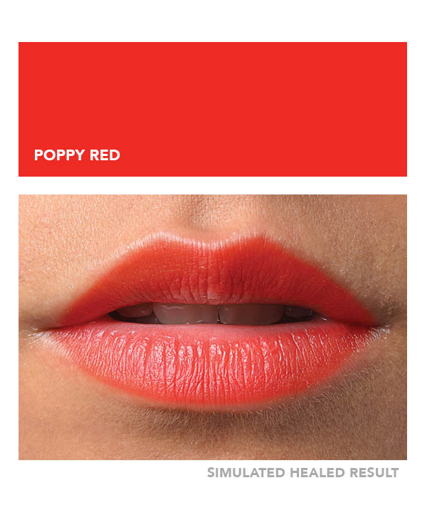 Poppy Red – Image 4