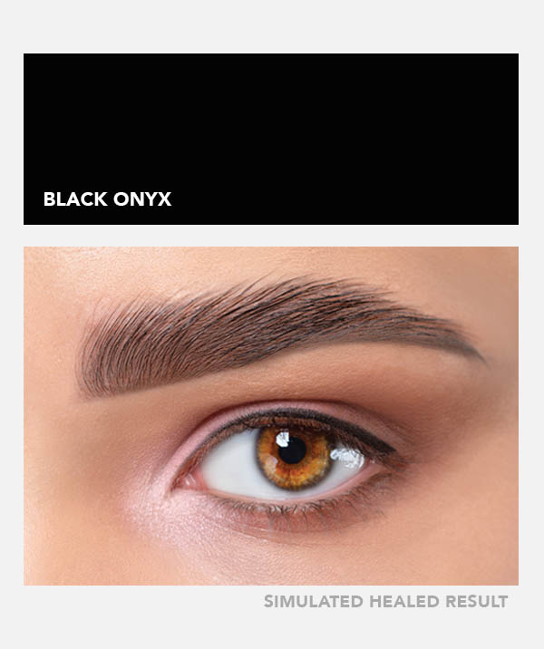 Black Onyx – Image 4