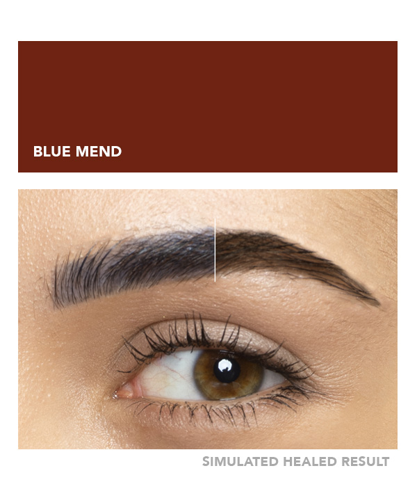 Blue Mend – Image 4