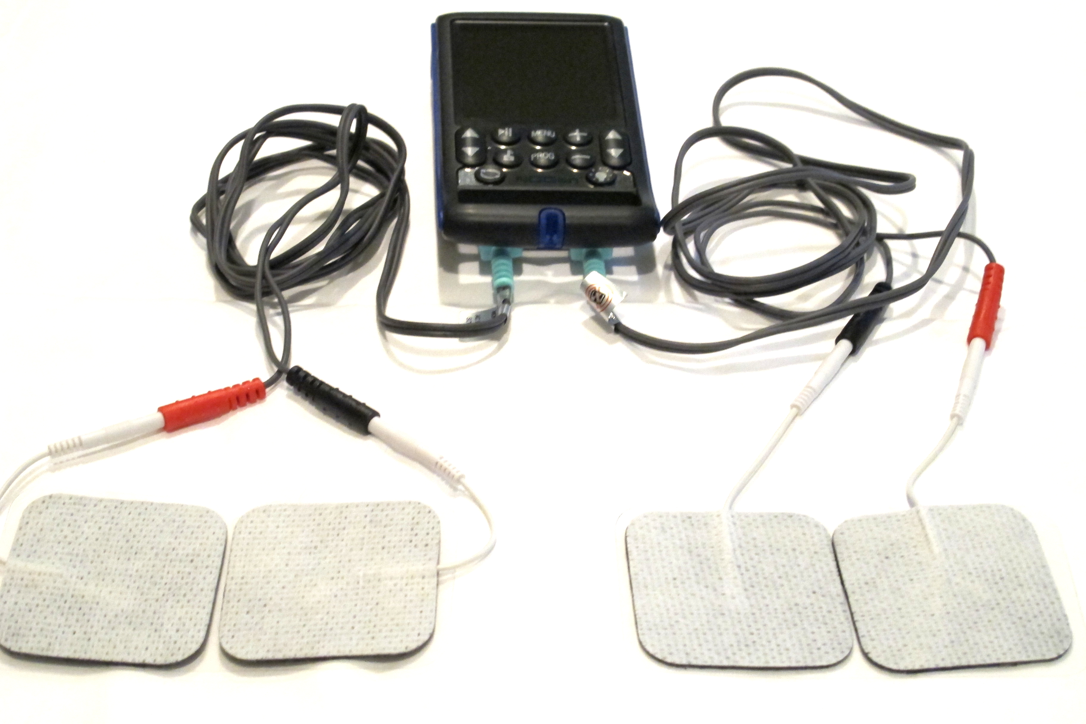 NDGen Portable Neurostimulator – Image 1
