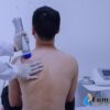 Lumsail SMART-WAVE Shockwave Therapy Device – Image 7