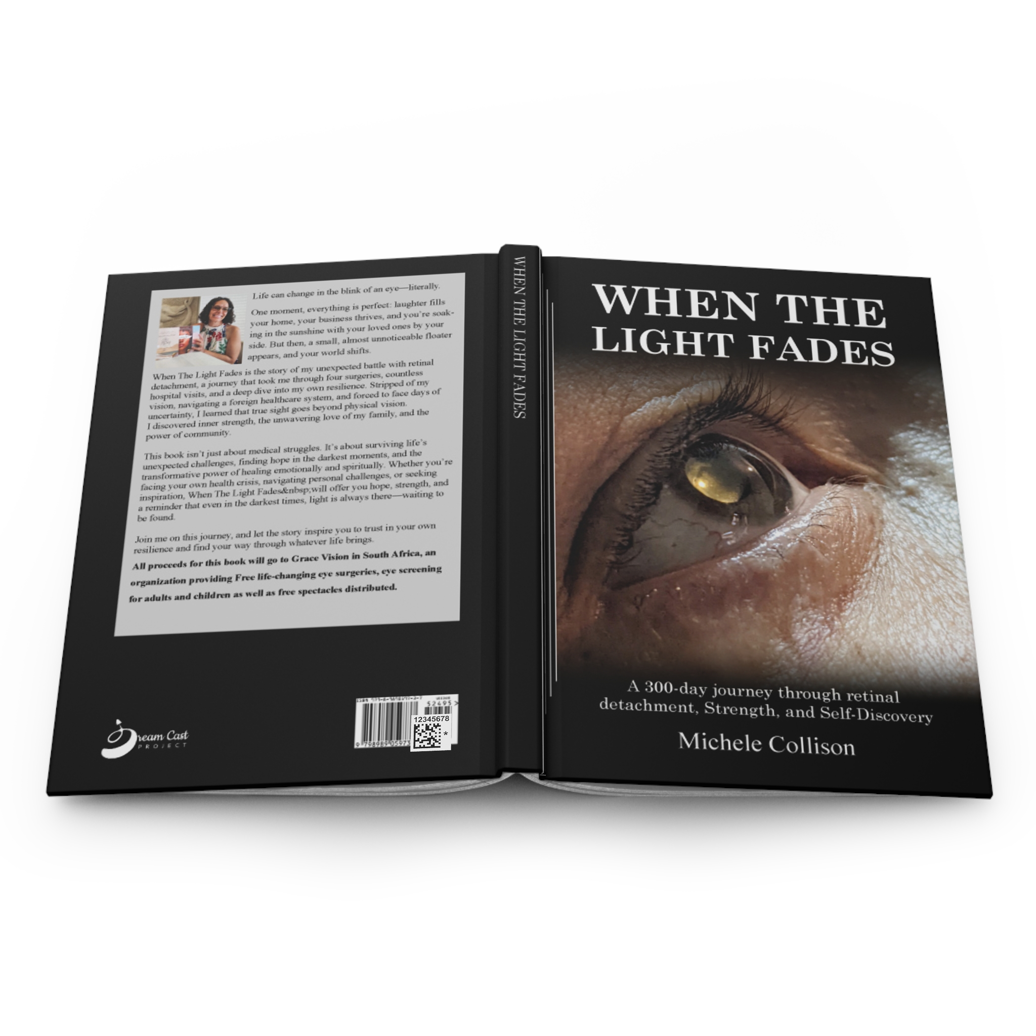 When The Light Fades, A 300-day journey through retinal detachment – Image 4