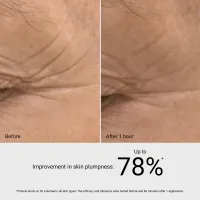 HYALURONIC FILLER SERUM – Image 2