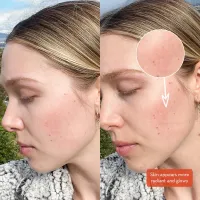 Lumenez Vitamin Rich Creme® – Image 3