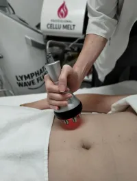 Advanced Lymphatic Wave Flush + RF Microneedling – Image 1