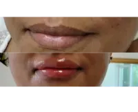 Permanent Makeup Lip Blush – Image 2