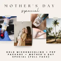 Gold Mother’s Day Microneedling Package (Full Face + PRP, Package of 3) – Image 1