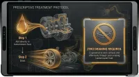Forte Automatic Transmission Treatment – Image 6