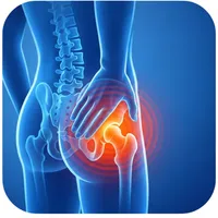 Relief Plan – Targeted Steroid Injection – Image 2